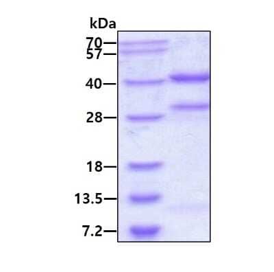 SDS-PAGE: Recombinant Human Protein Phosphatase 1C gamma His Protein [NBP2-59582]